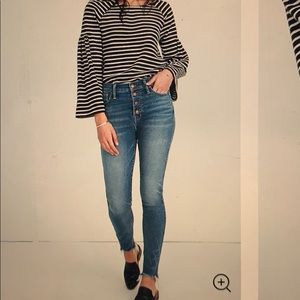 Madewell high-rise skinny jeans, button front